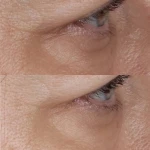 Perricone MD  Vitamin C Крем навколо очей VITAMIN C CCC + FERULIC BRIGHTENING UNDER-EYE CREAM 15 мл