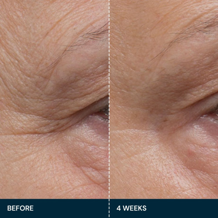 ELEMIS Досконала зміцнююча сироватка Про-Коллаген  Pro-Collagen Future Restore Serum  30 мл
