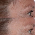 Perricone MD Есенція для обличчя COLD PLASMA PLUS+ THE ESSENCE 140 мл Perricone MD Есенція для обличчя COLD PLASMA PLUS+ THE ESSENCE 140 мл