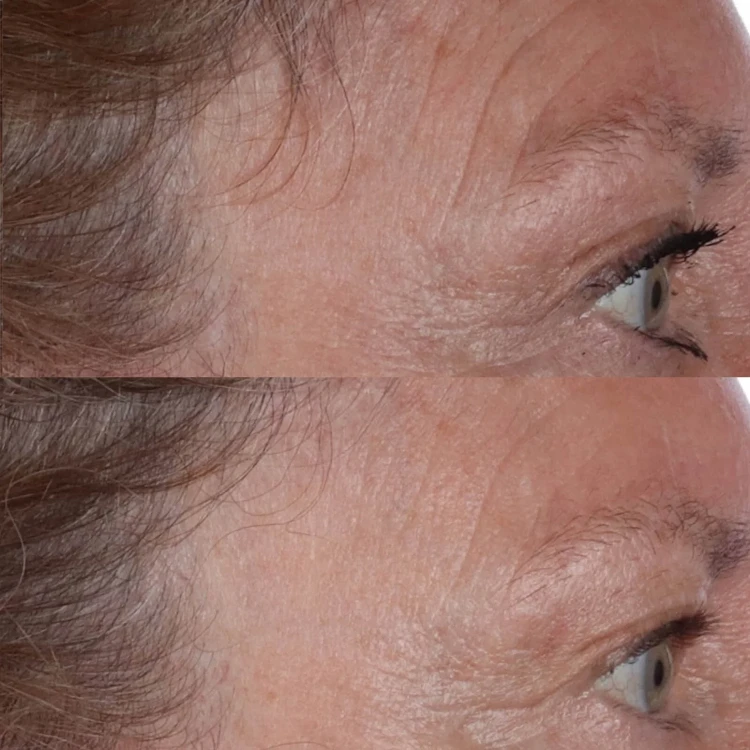 Perricone MD Есенція для обличчя COLD PLASMA PLUS+ THE ESSENCE 140 мл Perricone MD Есенція для обличчя COLD PLASMA PLUS+ THE ESSENCE 140 мл