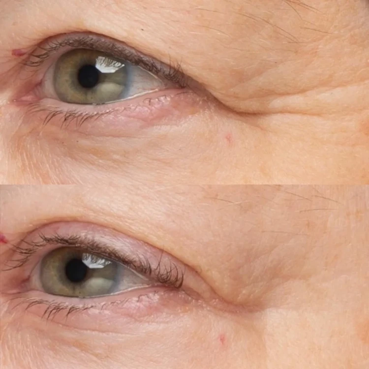 Perricone MD Крем інтенсивно зволожуючий COLD PLASMA PLUS+ THE INTENSIVE HYDRATING COMPLEX 118 мл Perricone MD Крем інтенсивно зволожуючий COLD PLASMA PLUS+ THE INTENSIVE HYDRATING COMPLEX 118 мл