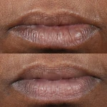  Perricone MD COLD Зволожуюча сироватка-помада  PLASMA PLUS+ LIP THERAPY 4,2 гр 