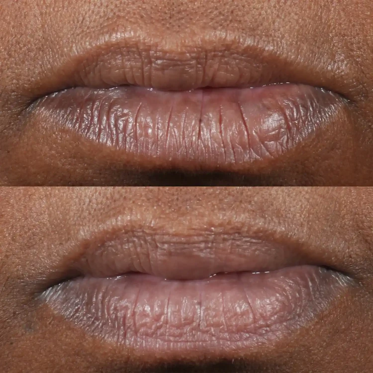  Perricone MD COLD Зволожуюча сироватка-помада  PLASMA PLUS+ LIP THERAPY 4,2 гр 