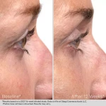 Obagi Nu-Cil Сироватка для покращення росту та об'єму вій  Eyelash Enhancing Serum 3 мл
