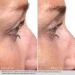 Obagi Nu-Cil Сироватка для покращення росту та об'єму вій  Eyelash Enhancing Serum 3 мл