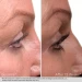 Obagi Nu-Cil Сироватка для покращення росту та об'єму вій  Eyelash Enhancing Serum 3 мл