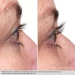 Obagi Nu-Cil Сироватка для покращення росту та об'єму вій  Eyelash Enhancing Serum 3 мл