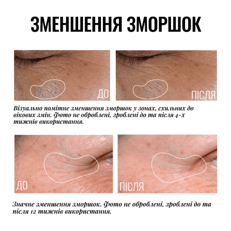 Instytutum  Крем-ліфтинг для повік з освітлювальним ефектом Truly-Transforming Brightening Eye Cream 15 мл