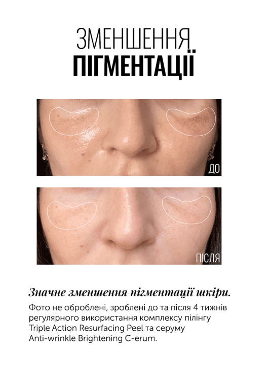 Instytutum  Суперконцентрований серум з вітаміном С Anti-wrinkle Brightening C-Erum  30 мл